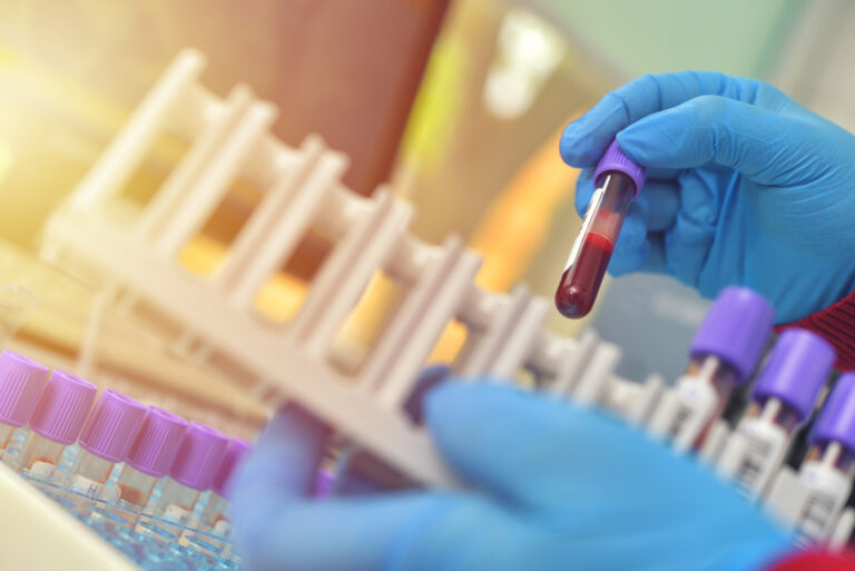 Blut, Blutzellen, Blutkrankheiten – aktuelle Forschung im Überblick