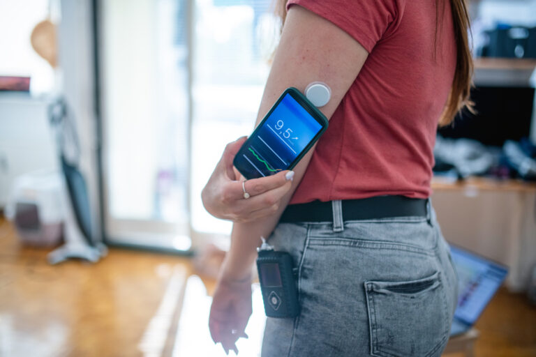 AID-Systeme sind bei Typ-1-Diabetes nicht mehr wegzudenken
