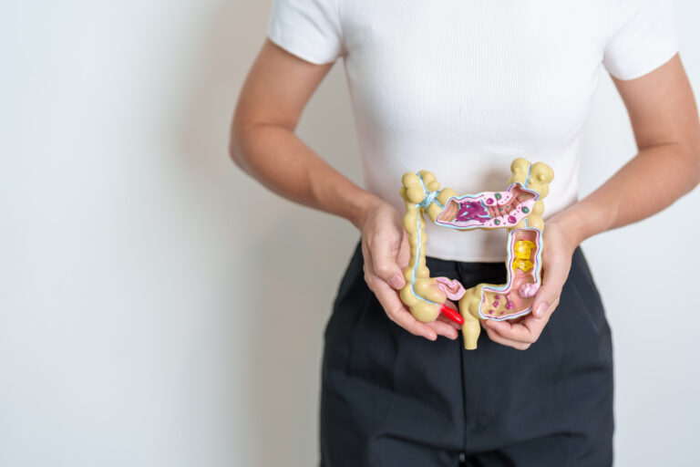 IUS zeigt prädiktiven Wert bei Colitis ulcerosa