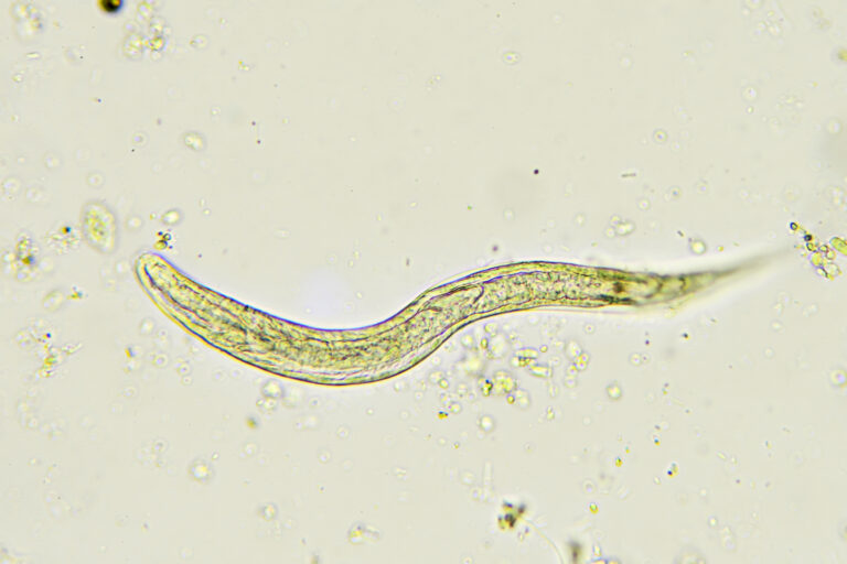 Zwergfadenwurm verursacht gastrointestinale Schmerzen