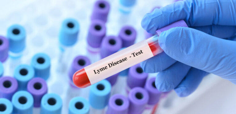 Wie hoch ist Seroprävalenz bei Kindern und Jugendlichen?