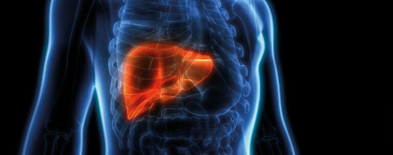 Risikopatienten auf NAFLD screenen